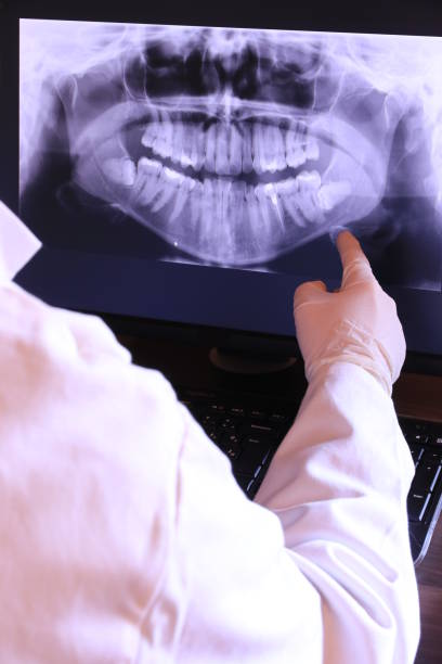 Best Root Canal Emergency Dentist  in Pearisburg, VA